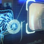 5 Beneficios en la actualidad de los rayos x: Descubre cómo esta tecnología revoluciona la medicina